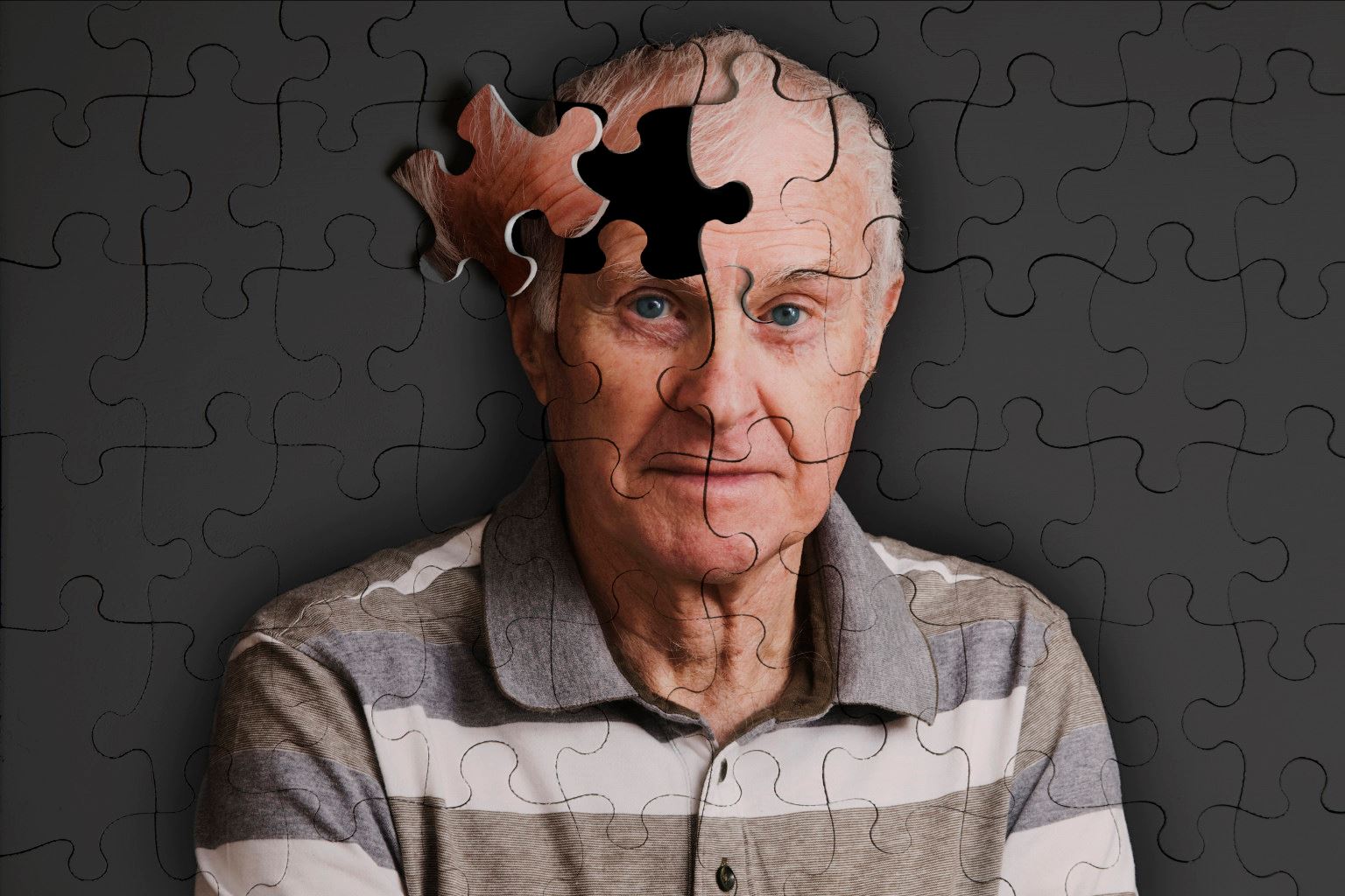 Alzheimer Hasta Bakımı